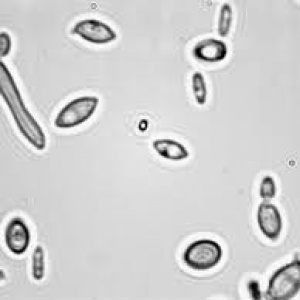 Brettanomyces bruxellensis